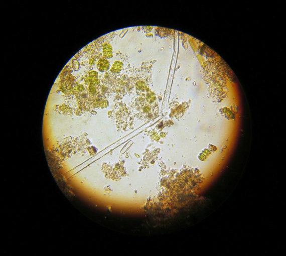 bacteria microscopic